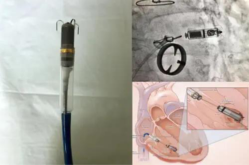 微信图片_20200410093418.jpg 微信图片_20200410093418.jpg